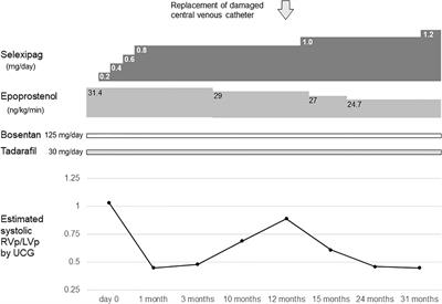 An Adolescent Patient With Idiopathic Pulmonary Arterial Hypertension Weaned Off Intravenous Epoprostenol Following Treatment With Selexipag: A Case Report